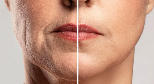 Say Good Bye to Wrinkles and Fine lines!